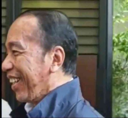 Jokowi Sakit Kulit Jadi Pembahasan Luas Publik Jokowi Sakit Kulit Jadi Pembahasan Luas Publik (X/@jhonsitorus_19)